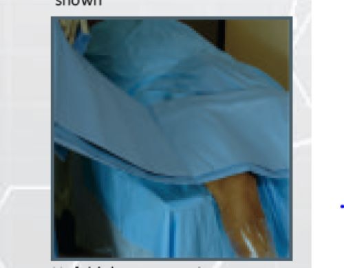 Arthroscopy Drape Eco E518