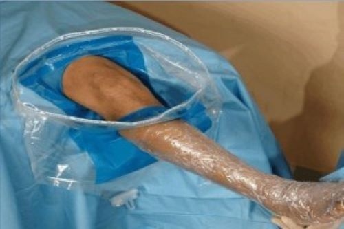 Arthroscopy Surgical Drape D508