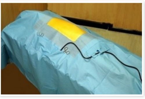 Major Surgery Drape Pack E-111