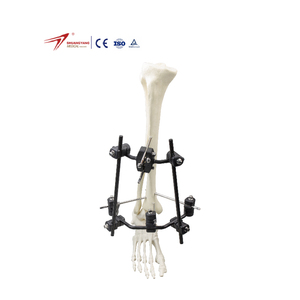 China Manufacture Fixat External Fixator Tibiaaxis Unilateral Frame Frame Femur & Tibia External Fixator For Orthopedic Surgery